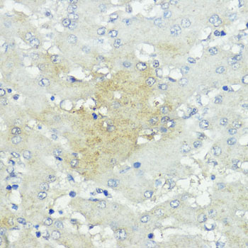 Anti-SOCS5 Rabbit pAb