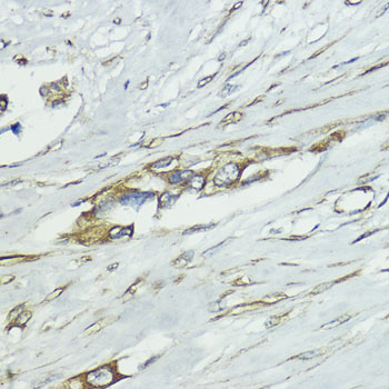 Anti-SOCS5 Rabbit pAb