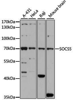 Anti-SOCS5 Rabbit pAb