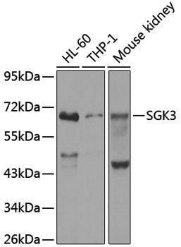 Anti-SGK3 Rabbit pAb