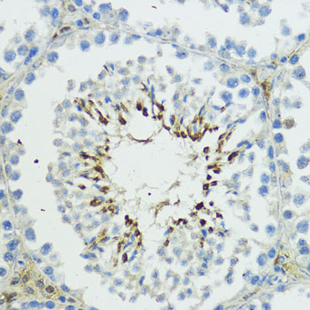 Anti-TRIP12 Rabbit pAb