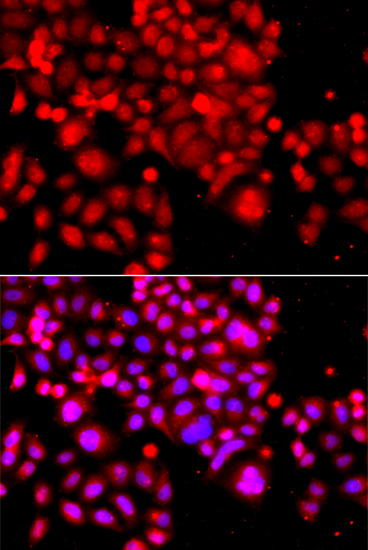 Anti-ASCC3 Rabbit pAb