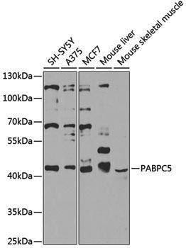 Anti-PABPC5 Rabbit pAb
