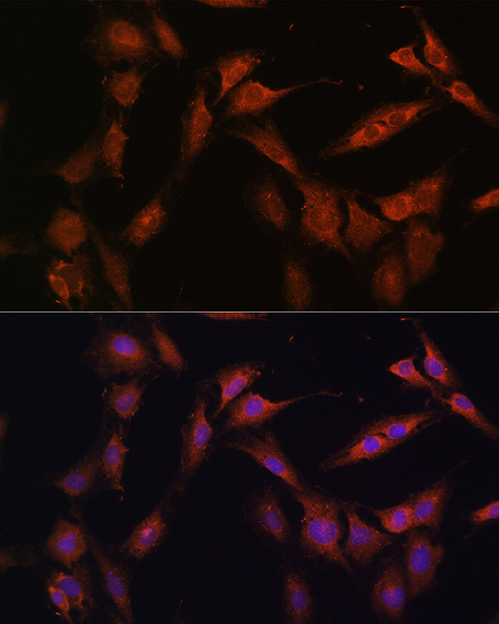 Anti-PFKFB2 Rabbit pAb