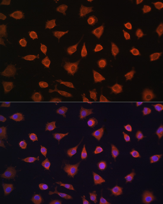 Anti-PFKFB2 Rabbit pAb