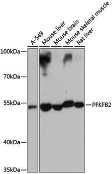 Anti-PFKFB2 Rabbit pAb