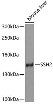 Anti-SSH2 Rabbit pAb