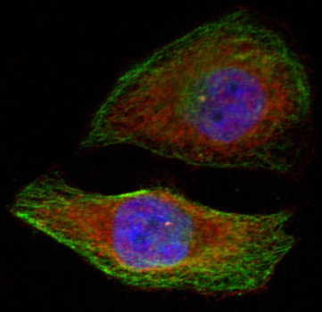Anti-Phospho-ERK1 (Thr202) /ERK2 (Thr185) Rabbit pAb