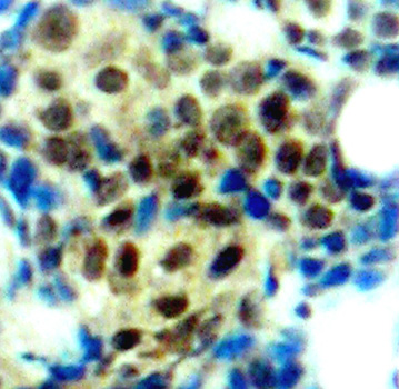 Anti-Phospho-ERK1 (Thr202) /ERK2 (Thr185) Rabbit pAb