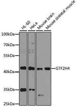 Anti-GTF2H4 Rabbit pAb