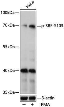 Anti-Phospho-SRF (Ser103) Rabbit pAb