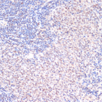 Anti-Phospho-SRF (Ser103) Rabbit pAb