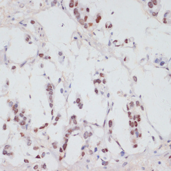Anti-Phospho-SRF (Ser103) Rabbit pAb