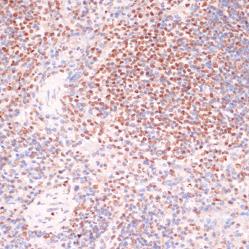 Anti-Phospho-SRF (Ser103) Rabbit pAb