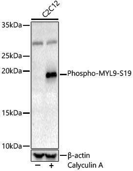 Anti-Phospho-MYL9 (Ser19) Rabbit pAb