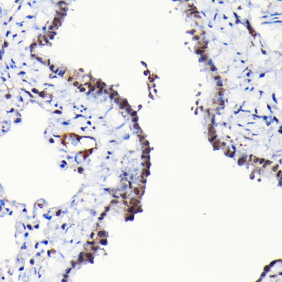 Anti-RGS14 Rabbit pAb