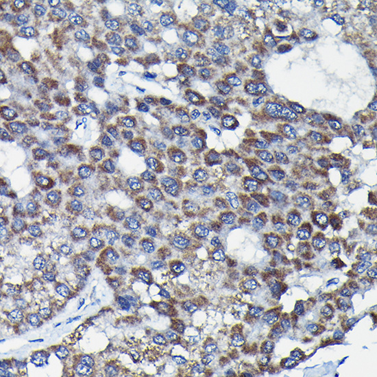 Anti-RGS14 Rabbit pAb