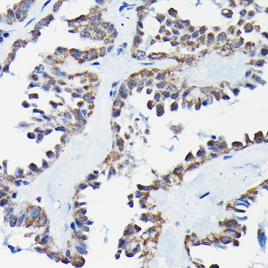 Anti-RGS14 Rabbit pAb