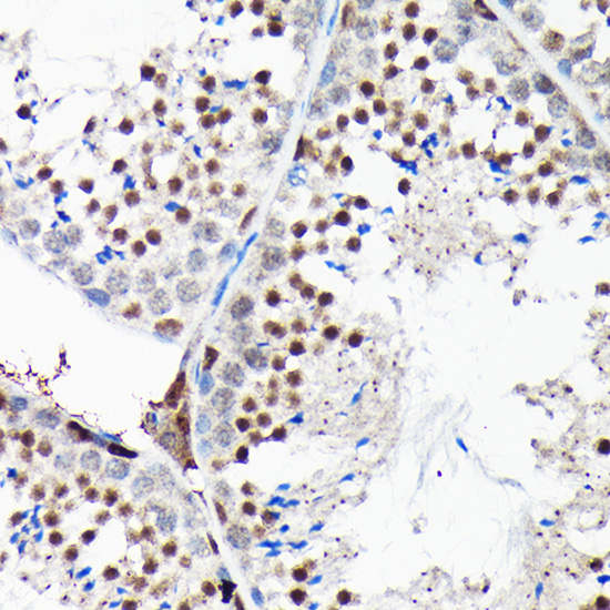 Anti-RGS14 Rabbit pAb