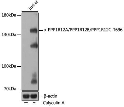 Anti-Phospho-PPP1R12A/PPP1R12B/PPP1R12C (Thr696) Rabbit pAb