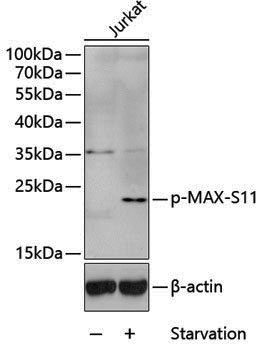 Anti-Phospho-MAX (Ser11) Rabbit pAb