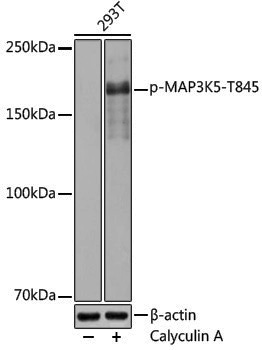 Anti-Phospho-MAP3K5 (Thr845) Rabbit pAb
