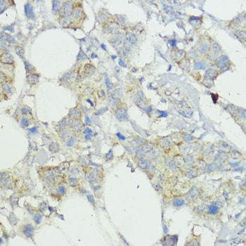 Anti-SOCS6 Rabbit pAb