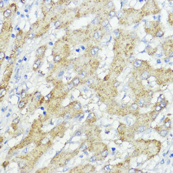 Anti-SOCS6 Rabbit pAb