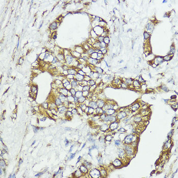 Anti-SOCS6 Rabbit pAb