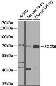 Anti-SOCS6 Rabbit pAb