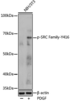 Anti-Phospho-SRC Family (Tyr416) Rabbit pAb