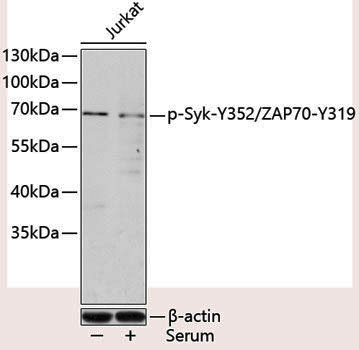 Anti-Phospho-Syk (Tyr352) /ZAP70 (Tyr319) Rabbit pAb