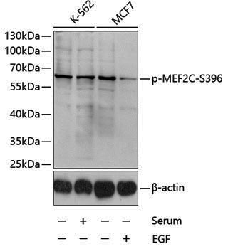 Anti-Phospho-MEF2C (Ser396) Rabbit pAb