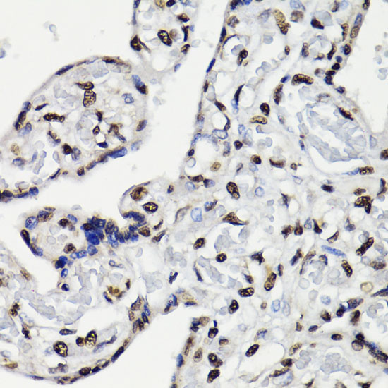 Anti-Phospho-STAT5 (Tyr694) Rabbit pAb