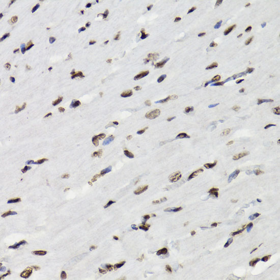 Anti-Phospho-STAT5 (Tyr694) Rabbit pAb