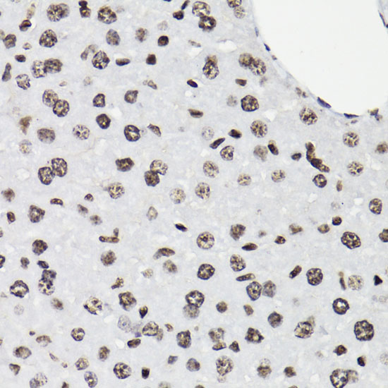 Anti-Phospho-STAT5 (Tyr694) Rabbit pAb