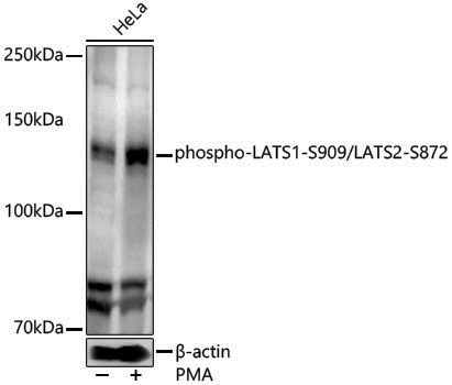 Anti-phospho-LATS1-S909/LATS2 (Ser872) Rabbit pAb