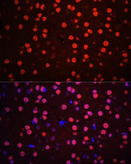 Anti-Phospho-p38 MAPK (Thr180/Tyr182) Rabbit pAb