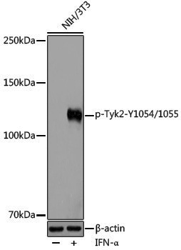Anti-Phospho-Tyk2 (Tyr1054/Tyr1055) Rabbit pAb