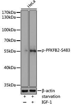 Anti-Phospho-PFKFB2 (Ser483) Rabbit pAb