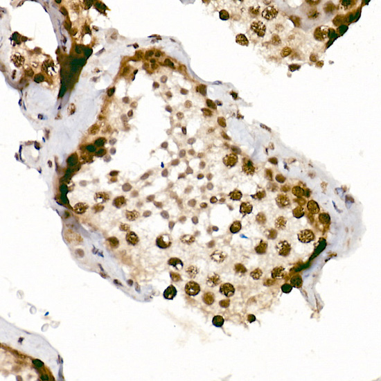 Anti-Phospho-ATR (Ser428) Rabbit pAb