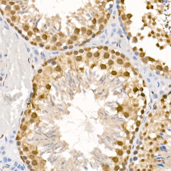 Anti-Phospho-ATR (Ser428) Rabbit pAb