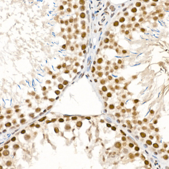 Anti-Phospho-ATR (Ser428) Rabbit pAb