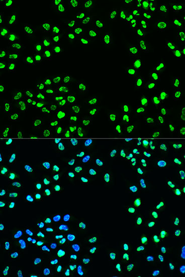 Anti-Phospho-ATR (Ser428) Rabbit pAb