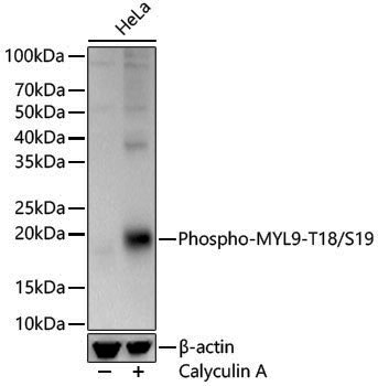 Anti-Phospho-MYL9 (Thr18/Ser19) Rabbit pAb