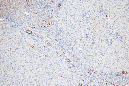 Anti-Phospho-MYL9 (Thr18/Ser19) Rabbit pAb