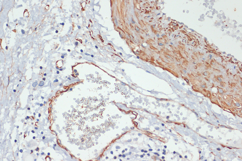 Anti-Phospho-MYL9 (Thr18/Ser19) Rabbit pAb