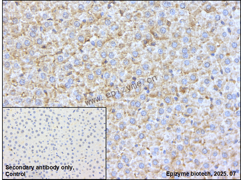 Anti-eIF4A1 Rabbit mAb [46L84K88]
