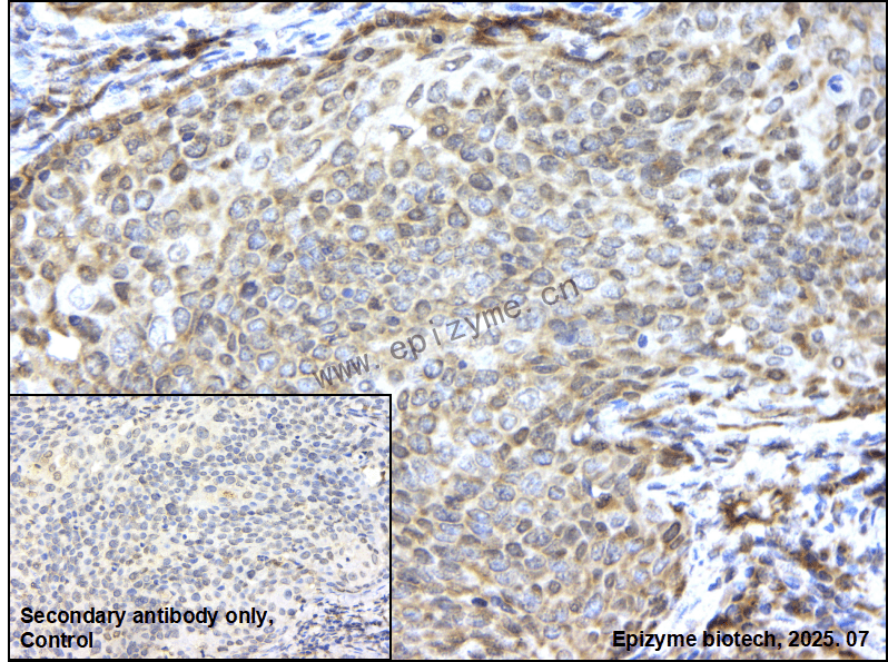 Anti-eIF4A1 Rabbit mAb [46L84K88]