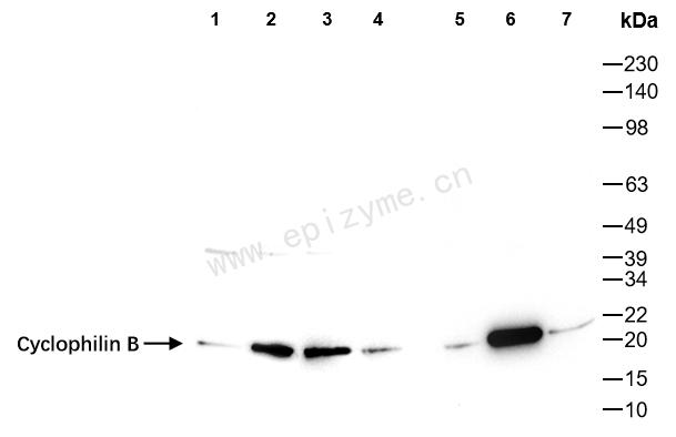 Anti-Cyclophilin B Rabbit mAb [46M55K99]